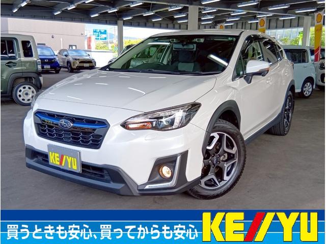 ＸＶ画像