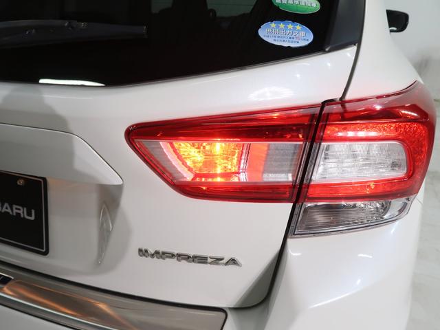 �����Z���Ȃǂ̈��V�󎞂̒Ǔ˖h�~�Ɍ��ʃA���I�����t�H�O�����v�ł��I�I