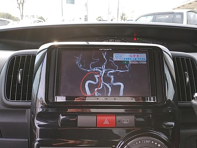 タント カスタムＸ　ブルートゥース　ＥＴＣ車載器　　禁煙車　　片側電動スライドドア（35枚目）