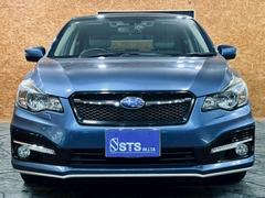 �桼������ľ�ܻ����졡�ȣɣĥإåɥ饤�ȡ��ǥ��饤�ȡ�����������������ס��ҳ��ʥӡ��ե륻���ԣ֡��£����������衡�Хå�����顡�ϡ��ե쥶�������ȡ��ѥ�����ȡ��졼�������롼�����ɥ�쥳���ţԣ� 3