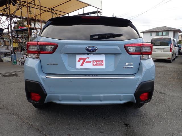 �G�b�W�̌������f�U�C�����ƂĂ��ǂ������ł��l���ڗ��L�Y�≚�݂͂���܂��񃈁�