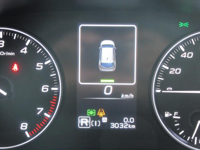 �o�b�N���ɁA�o�b�N�\�i�[���N�����A�󋵂�\���������܂�