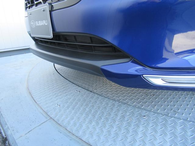 �f�B�[���[�I�v�V�����̃t�����g�A���_�[�X�|�C���[�𑕔�