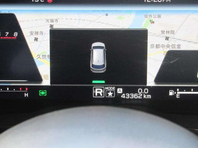 �o�b�N���ɁA�o�b�N�\�i�[���N�����A�󋵂�\���������܂�