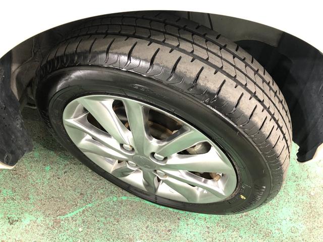 �_�C�n�c�����I�v�V�����̃A���~�z�C�[�������I�^�C�����܂��܂����ꂩ��ł��ˁ�