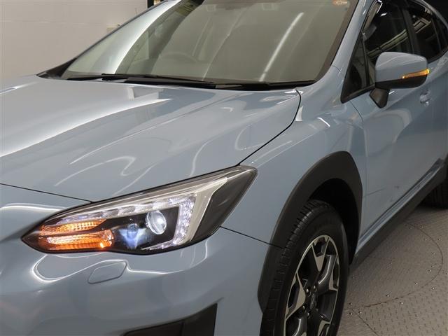 �w�b�h���C�g�̃����Y���N���[�j���O�ς݂ł��I�ƂĂ��Y��ł����@�����Y������Ă���Ɩ{���̖��邳���o�܂����I