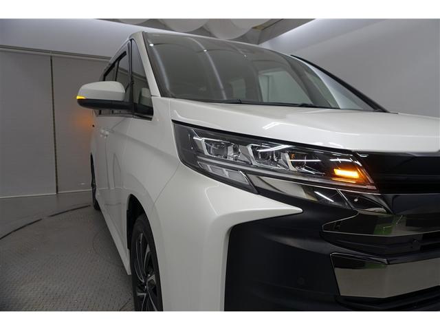 �w�b�h���C�g�̃����Y���N���[�j���O�ς݂ł��I�ƂĂ��Y��ł����@�����Y������Ă���Ɩ{���̖��邳���o�܂����I