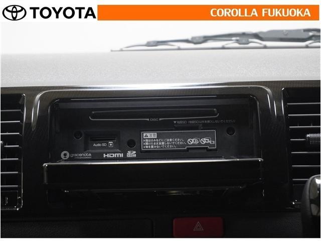 �I�[�f�B�I�������O�����ۏ؂̑Ώۂł��B������A�̏�̍ۂ����S�̃T�|�[�g���󂯂��܂��B