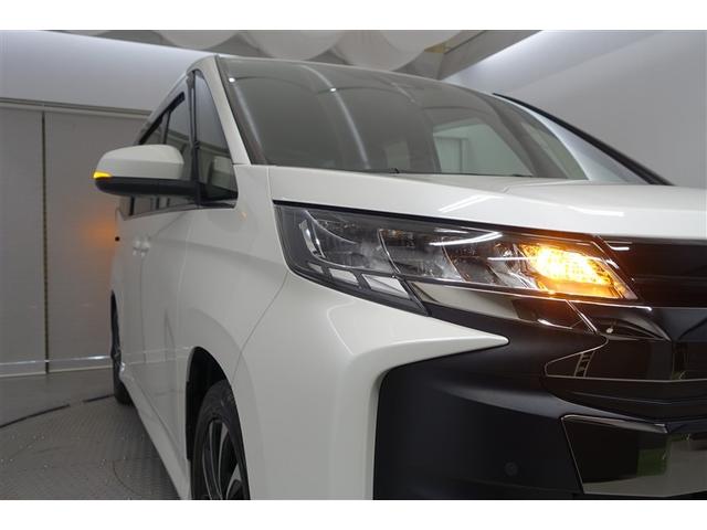 �w�b�h���C�g�̃����Y���N���[�j���O�ς݂ł��I�ƂĂ��Y��ł����@�����Y������Ă���Ɩ{���̖��邳���o�܂����I