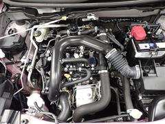 �ܥǥ��Τ������줬�饯�饯�ãУå�ᥤ���ܹ� 6