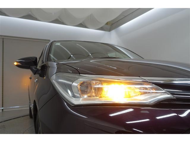 �w�b�h���C�g�̃����Y���N���[�j���O�ς݂ł��I�ƂĂ��Y��ł����@�����Y������Ă���Ɩ{���̖��邳���o�܂����I