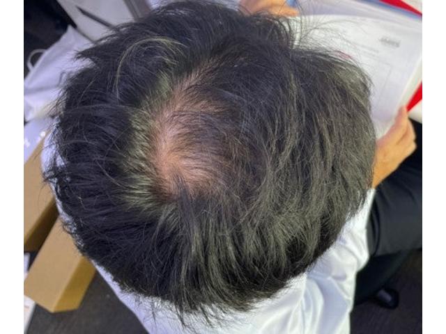 ハゲ・・・（田頭）【尾道市　福山市　三原市でお車の整備・車検・メンテナンス・修理/ 板金・塗装　全部マルっと　カープランニング広島　へまかせんさい！！】